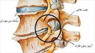 ستون فقرات تان را با این روش ها مراقبت کنید