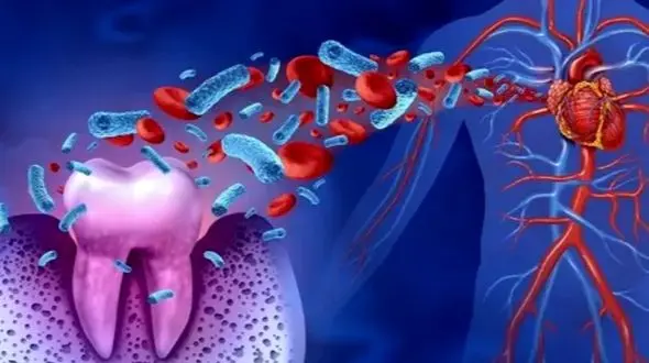 دهان؛ قاتل خاموش قلب شما