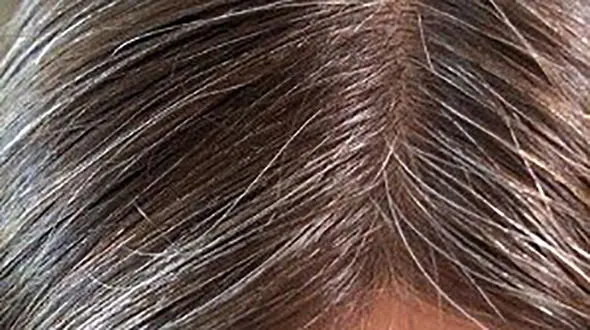 کوتاه کردن مو سرعت رشد را افزایش می‌دهد؟ 