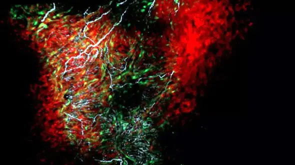 کشف جدید در ساختار قلب 