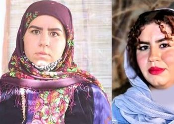 فیلم جگرسور / روناک سریال نون خ: دلم شکست وقتی آدم نزدیک زندگیم گفت نمیتونم با ظاهرت ارتباط بگیرم! / گفتم نکنه من واقعا زشتم !