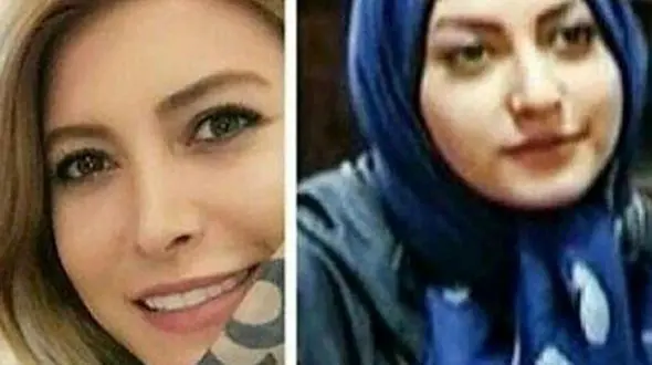 تغییر چهره بازیگران ایرانی با عمل‌های زیبایی+فیلم 