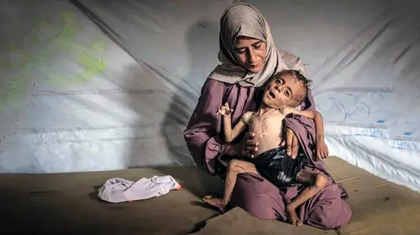 فاجعه انسانی در غزه / مرگ پی در پی کودکان و نوزادان غزه از شدت گرسنگی