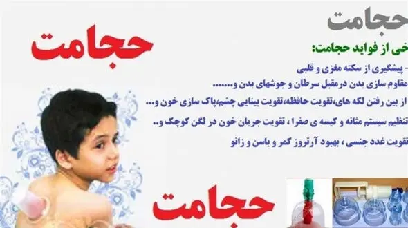 درمان انواع بیماری ها با حجامت