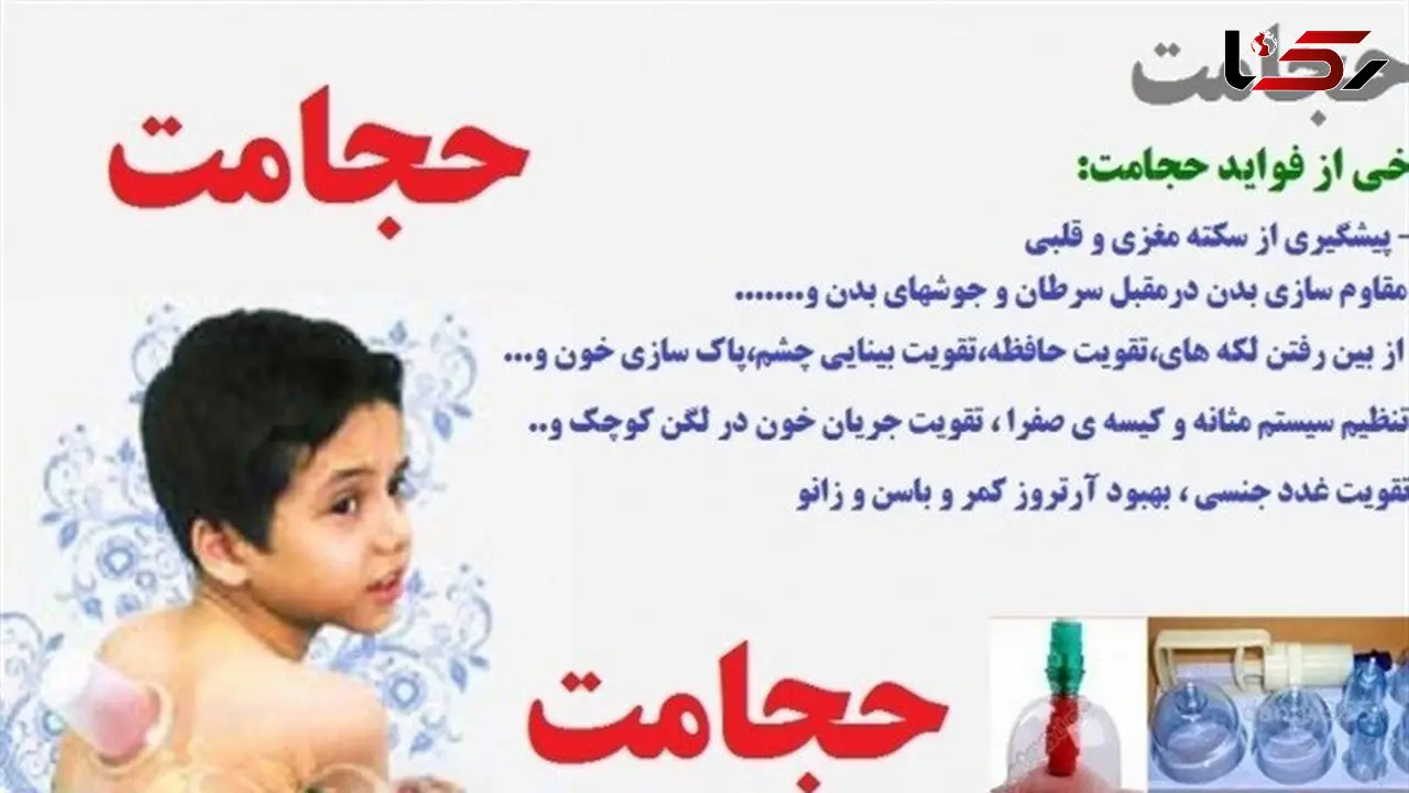 درمان انواع بیماری ها با حجامت