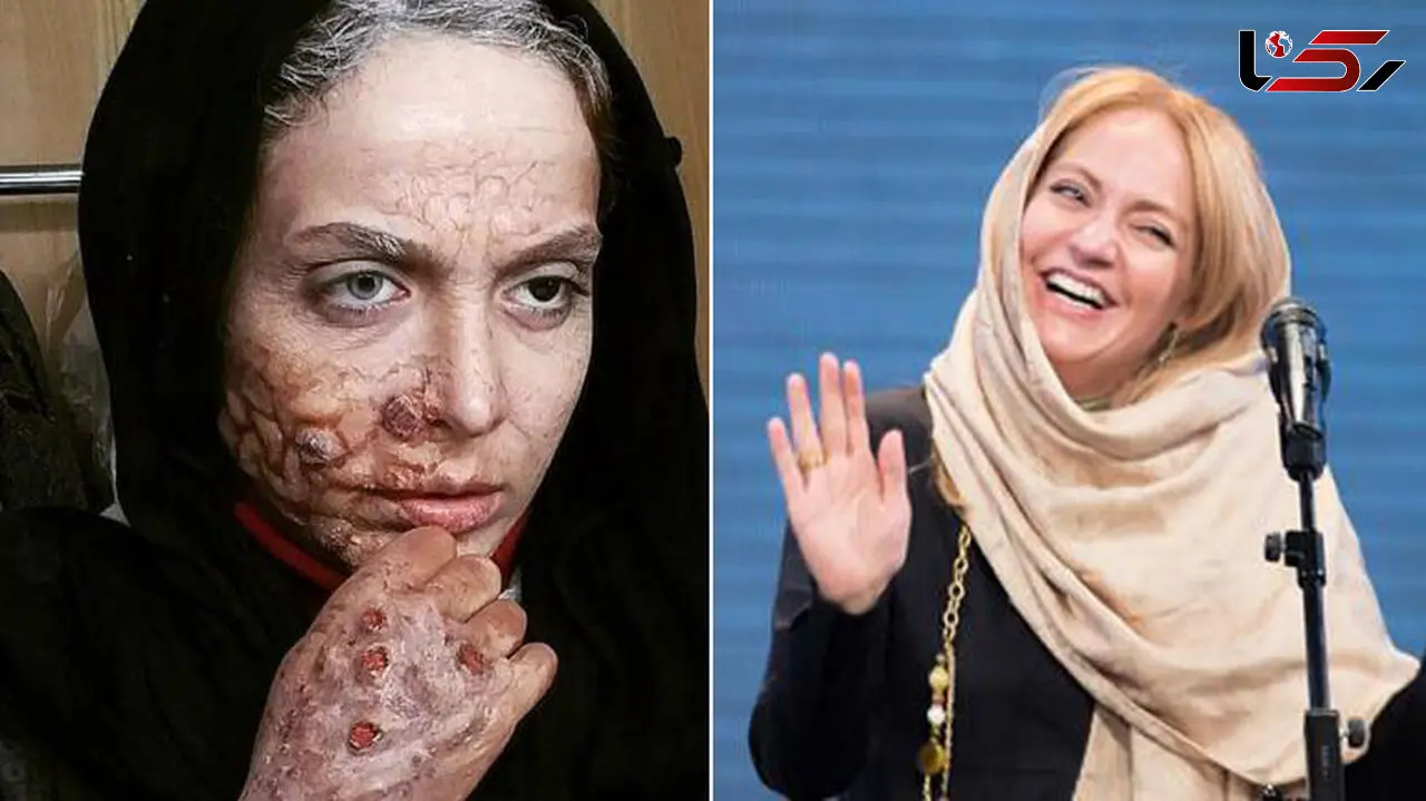 عکس مهناز افشار بازیگر مشهور ایرانی با گریم زامبی