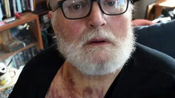 بی احتیاطی راننده سالخورده حادثه ساز شد +عکس