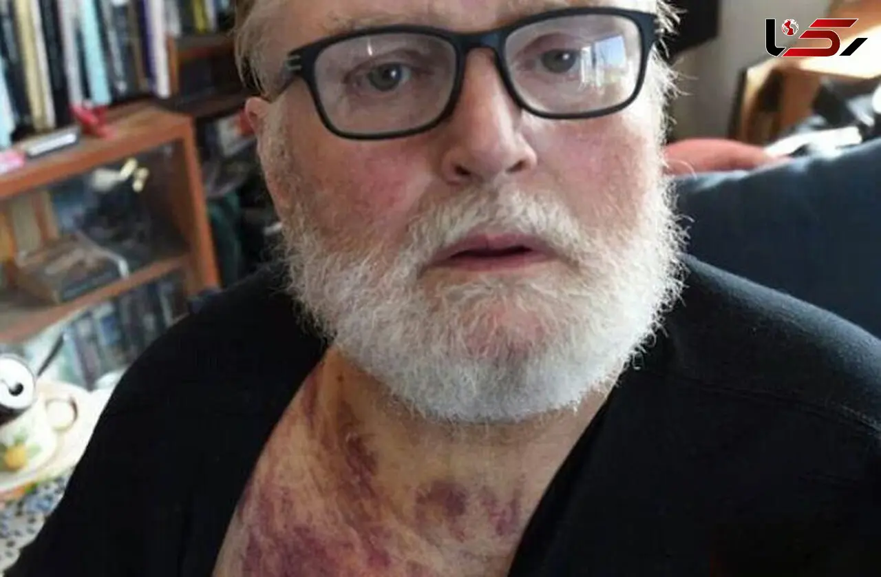 بی احتیاطی راننده سالخورده حادثه ساز شد +عکس