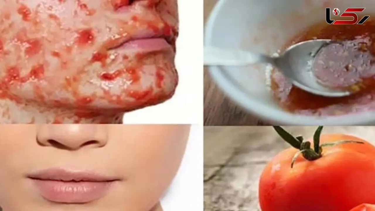 با این ماسک پوستت را عالی کن!