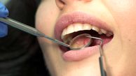 سفید کردن دندان ها با ساده ترین روش