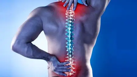 تنگی کانال نخاع چیست؟ / علت تنگی کانال نخاعی + جدول