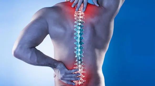 تنگی کانال نخاع چیست؟ / علت تنگی کانال نخاعی + جدول