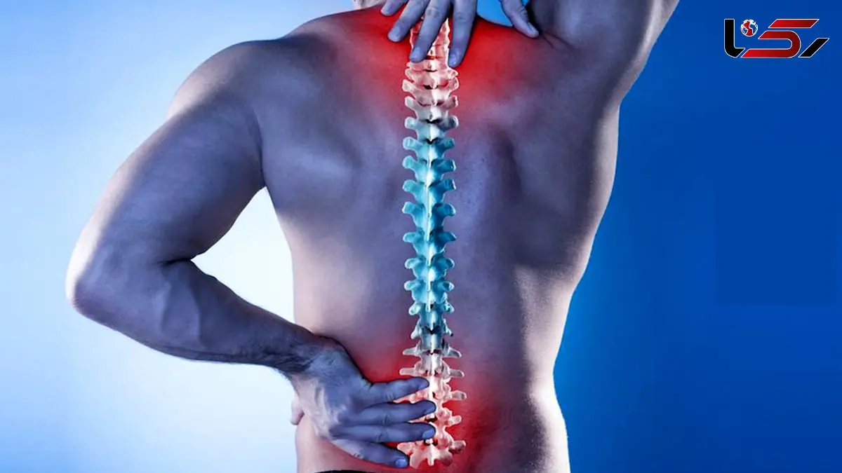 تنگی کانال نخاع چیست؟ / علت تنگی کانال نخاعی + جدول
