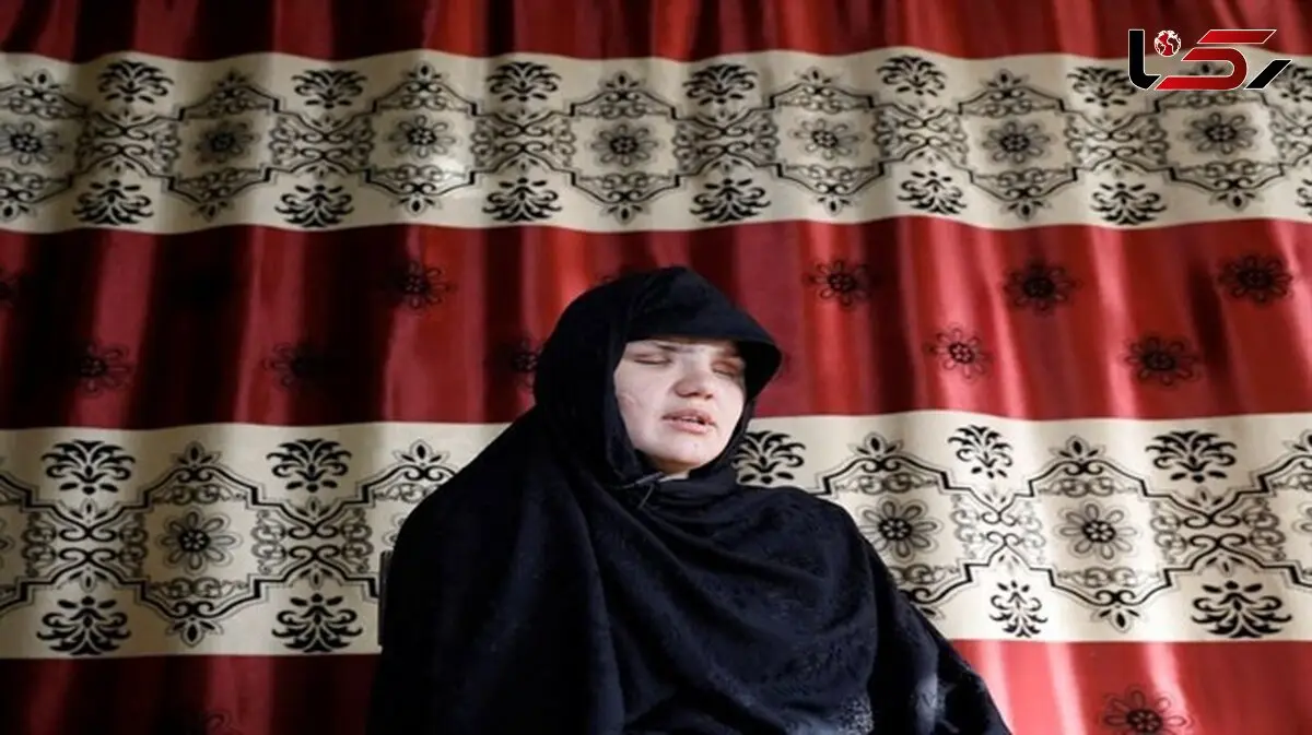  چشم‌های خاطره ۳۳ ساله  از حدقه درآمد + عکس زن افغانستانی