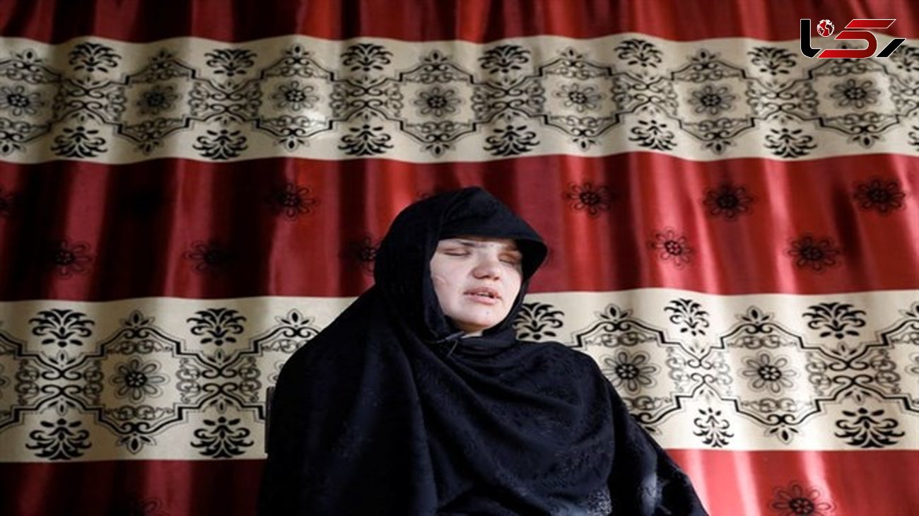  چشم‌های خاطره ۳۳ ساله  از حدقه درآمد + عکس زن افغانستانی
