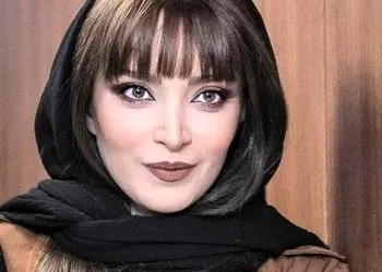 بهنوش طباطبایی تغییر چهره داد / خانم بازیگر با این چهره قابل نمی شناسید!