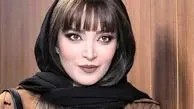 بهنوش طباطبایی تغییر چهره داد / خانم بازیگر با این چهره  نمی شناسید!