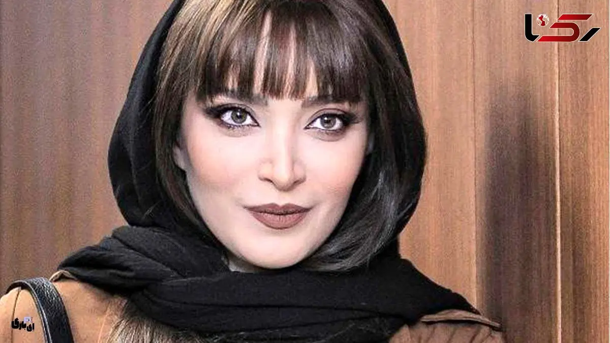 بهنوش طباطبایی تغییر چهره داد / خانم بازیگر با این چهره قابل نمی شناسید!