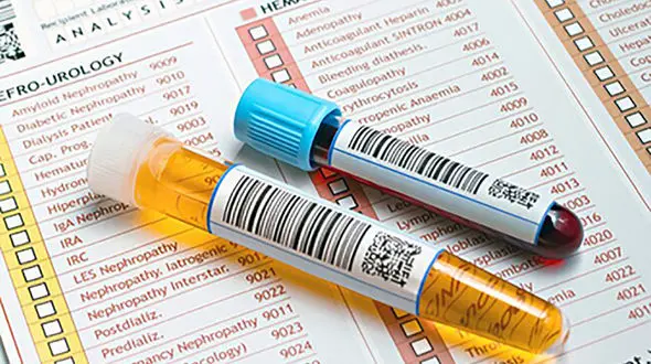 ادرار خونی را جدی بگیرید