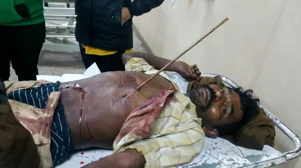 باور می کنید تیر رابین هودی در سینه این مرد است؟+تصاویر عجیب