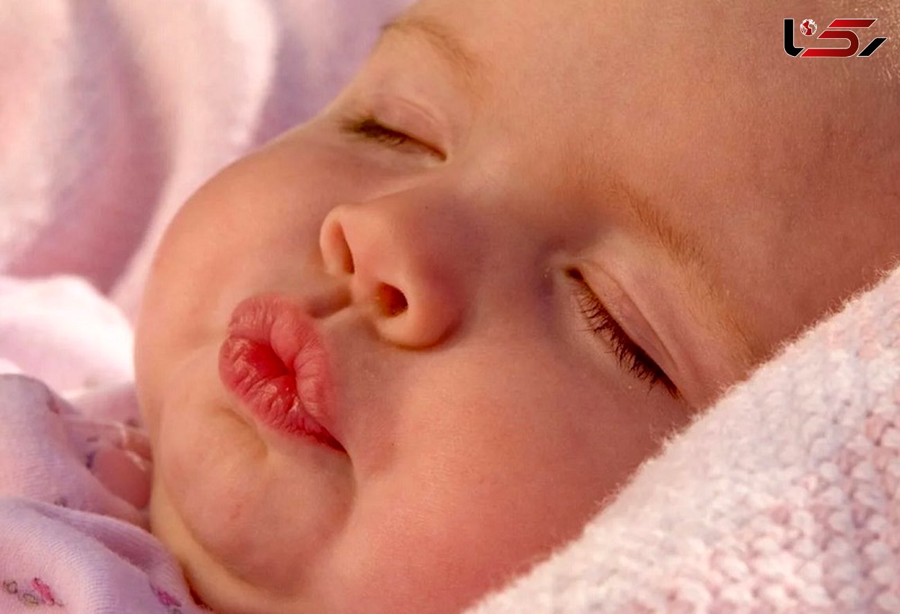 درمان ترک لب نوزادان با روش های خانگی