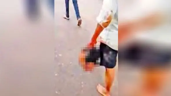 عکس / مردی با سر بریده مادرش به کلانتری رفت 