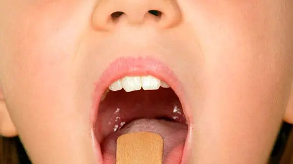 درمان سنگ لوزه با درمان های خانگی