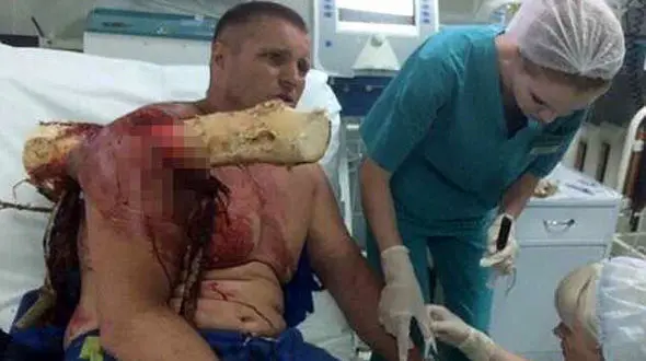 تصاویر عجیب از فرو رفتن تنه یک درخت بزرگ به داخل بدن مرد پاراگلایدرسوار ! +عکس