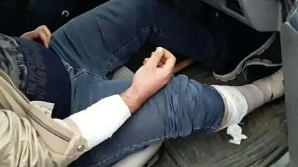 قاچاقچی چوب با خودرو از روی 2 جنگلبان رد شد + عکس