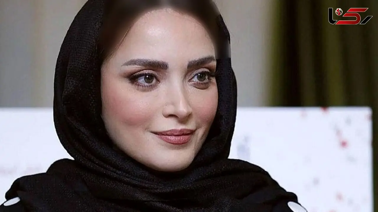 تغییر چهره زن اول مهدی پاکدل / جذابیت عروسکی  بهنوش طباطبایی با عمل های زیبایی + عکس ها و بیوگرافی