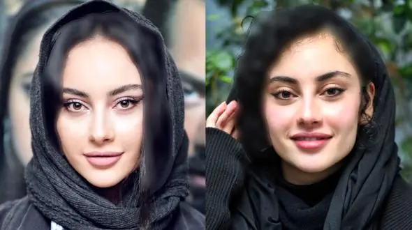 فیلم تغییر چهره جذاب ترلان پروانه /صورتش را کوبیده و از نو ساخته! / شوکه می شوید!