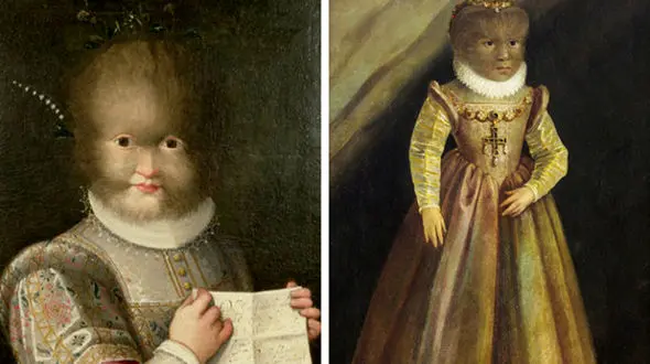 سرگذشت حقیقی ۷ انسان عجیب الخلقه که حیرت‌زده خواهید شد! +تصاویر 