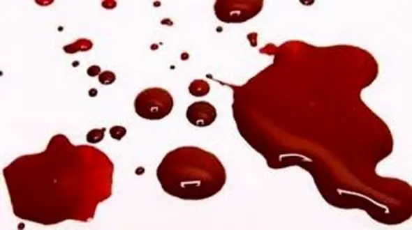 4 قتل در یک مرکز مشاوره + عکس قاتل روانی