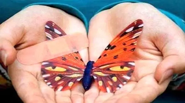 کمبودی در زمینه پانسمان بیماران ای بی وجود ندارد