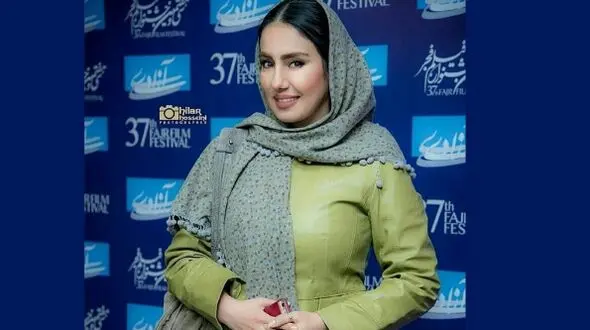 ژست های لاکچری  شیدا یوسفی بازیگر سریال نون خ در کنار اتومبیل های گران قیمت در دبی! / انگار ایرانی نیست!