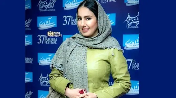 ژست های لاکچری  شیدا یوسفی بازیگر سریال نون خ در کنار اتومبیل های گران قیمت در دبی! / انگار ایرانی نیست!