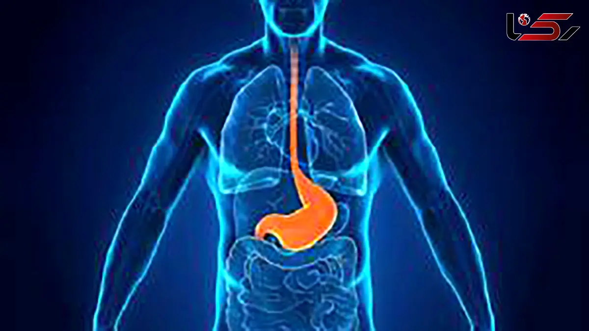 رفلاکس معده چه علائم غیرگوارشی دارد؟
