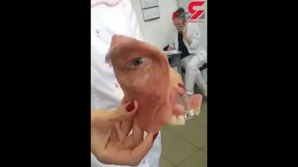 این سرباز صورت مصنوعی دارد + فیلم(16+)