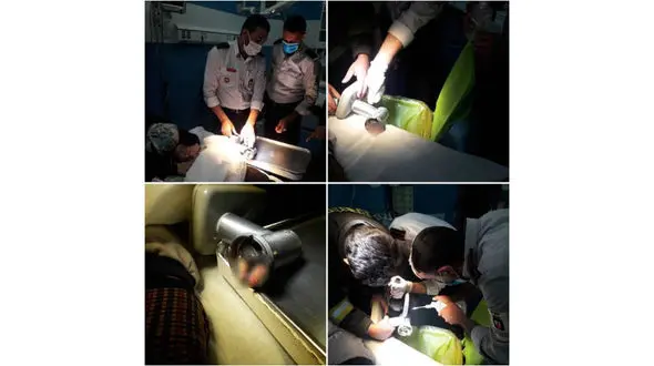 عکس چرخ شدن انگشتان دست پسربچه در چرخ گوشت / یزد