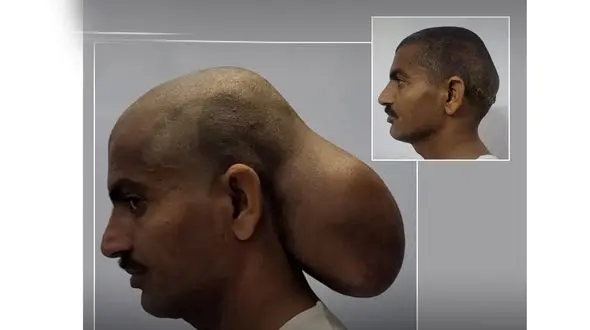  یک طالبی در سر مرد هندی جا شده بود ! / چی بود و چی شد ؟! + عکس