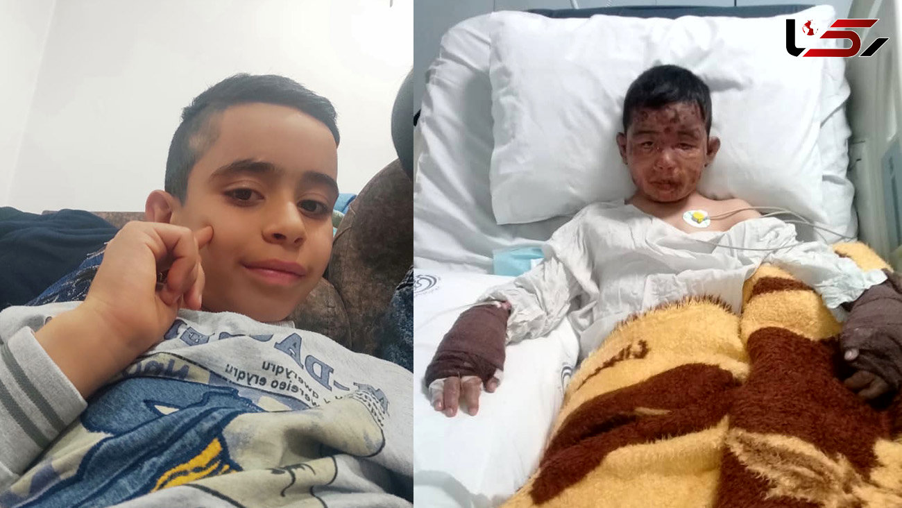 طاها 9 ساله سوخت تا 4 کودک زنده بمانند / ون ناگهان آتش گرفت + عکس و فیلم گفتگوی اختصاصی
