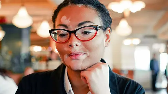 ایجاد لکه های سفید روی پوست + درمان