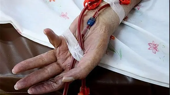 تعویض نوار بهداشتی در کمتر از دو ساعت، نشانه‌ای از احتمال هموفیلی / آموزش و پرورش برای شکستن تابوی قاعدگی به میدان بیاید + فیلم