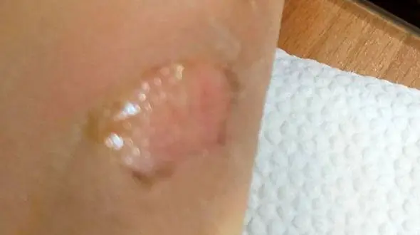 نامادری اراکی کودک 8 ساله را تا حد مرگ شکنجه داد 