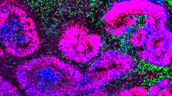 اولین اطلس توسعه مغز نشان می‌دهد چگونه سلول‌های بنیادی به نورون تبدیل می‌شوند