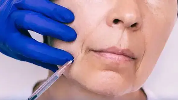 هشدار درباره مصرف ژل ها و محلول های تزریقی زیبایی