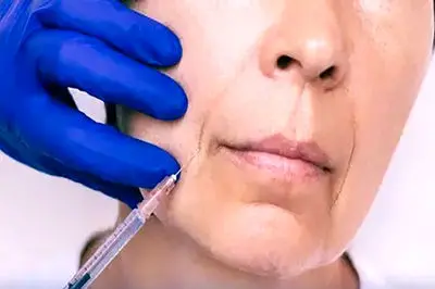 هشدار درباره مصرف ژل ها و محلول های تزریقی زیبایی