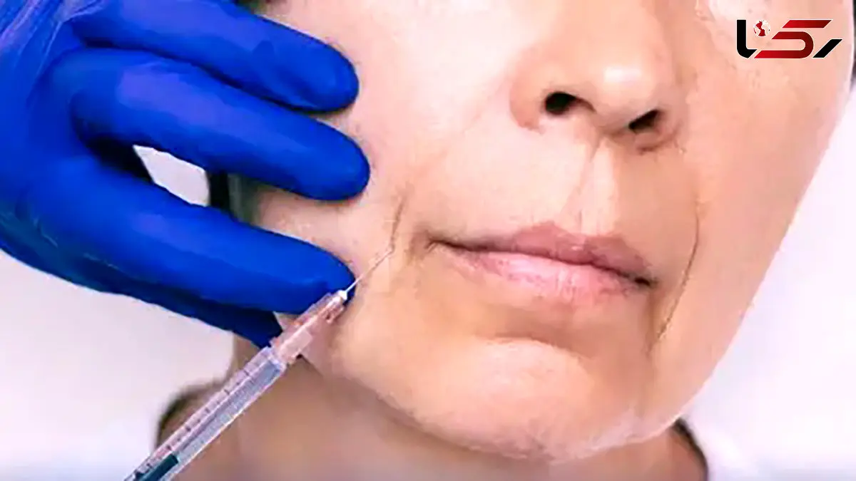 هشدار درباره مصرف ژل ها و محلول های تزریقی زیبایی