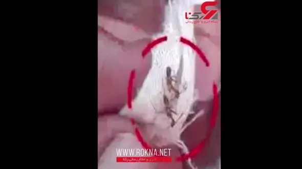 دختری در خواب بود که 60 مورچه وارد بدن او شد ! + فیلم