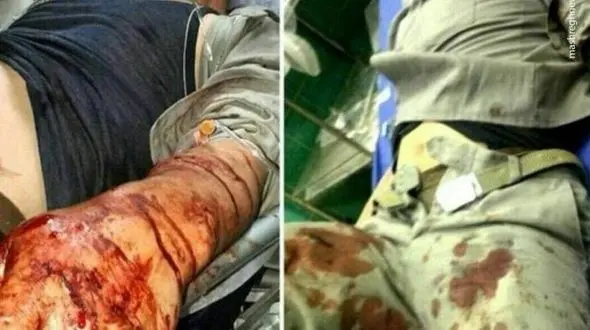 شلیک شکارچی متخلف به یک محیط‌بان در رامیان +عکس